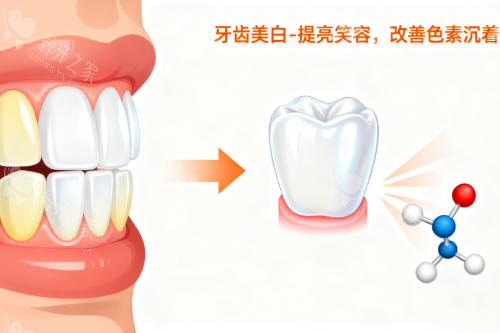 牙齿美白卡通图片一览 牙齿美白卡通图片一览