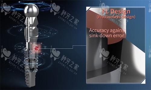 沃兰种植牙植体细节图