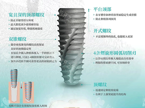韩国伊诺种植牙植体照片 韩国伊诺种植牙植体照片