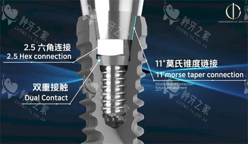 四会市2026看牙费用全解析:种植/正畸/补牙!