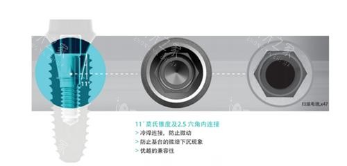 2025年福州牙科收费价目表:种植牙2980元起!