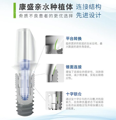 康盛亲水种植牙 康盛亲水种植牙