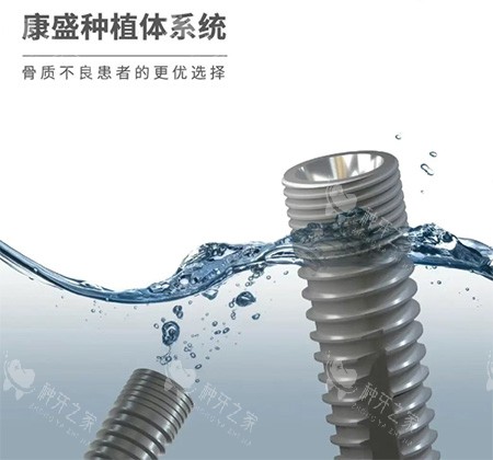 康盛种植牙怎么样