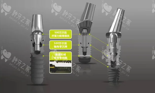 百康特种植牙怎么样 百康特种植牙怎么样