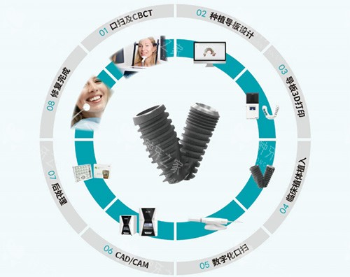 沃兰种植牙全部流程图 沃兰种植牙全部流程图