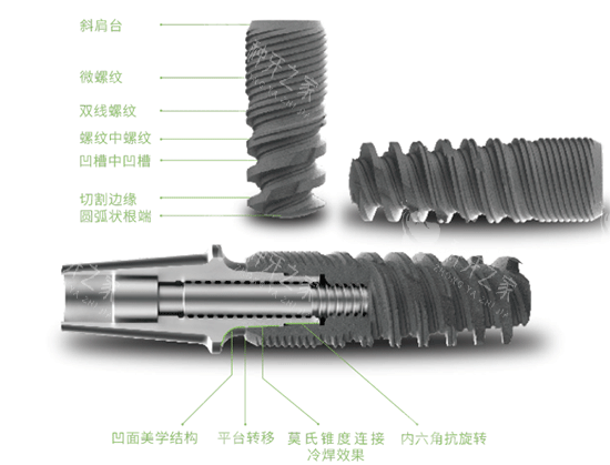 科惠种植牙种植体照片 科惠种植牙种植体照片