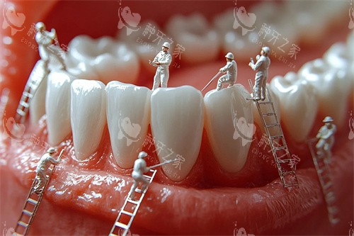 北京种牙价格攻略!1千-3万种牙方案差异解析