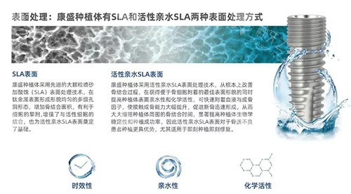 康盛种植牙表面设计图片 康盛种植牙表面设计图片