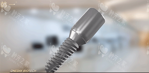 韩一种植牙好不好 韩一种植牙好不好