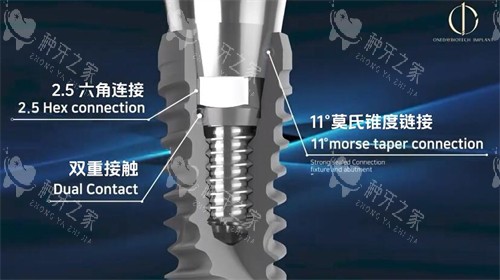 种植牙疼吗?过来人揭秘术后3天真实感受