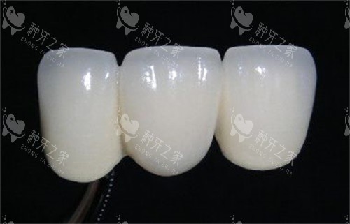 全瓷牙图 全瓷牙图