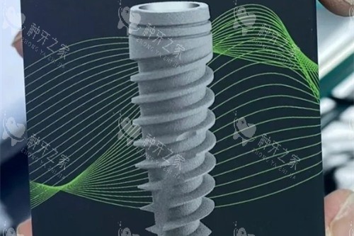 意大利BB种植牙 意大利BB种植牙