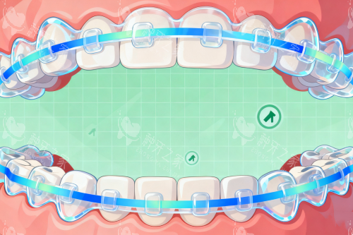 牙齿矫正卡通图片展示
