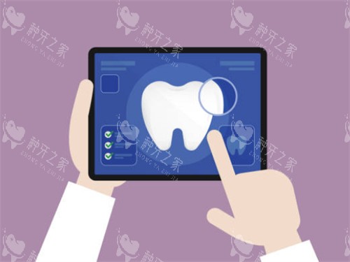 种植牙检查平板图 种植牙检查平板图