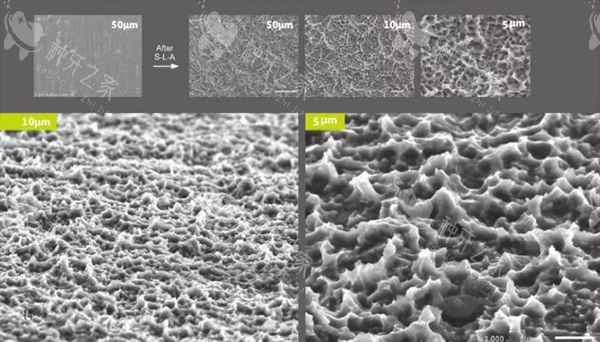 百康特种植牙设计优势
