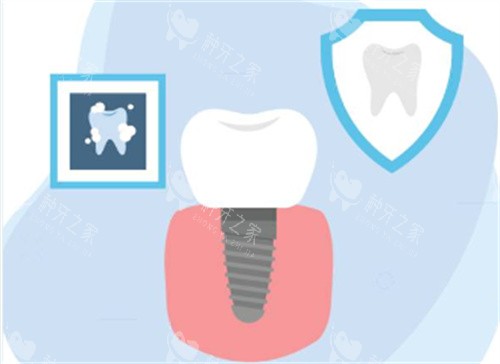 玉林牙博士口腔医院种植牙怎么样？经验足性价比高