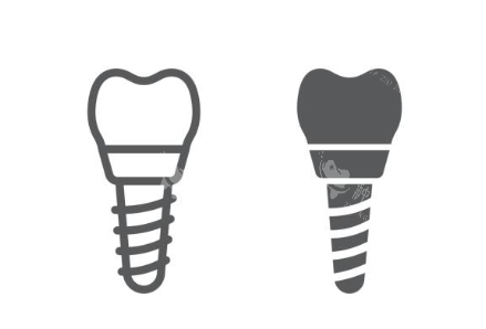 种植牙logo图示意图 种植牙logo图示意图