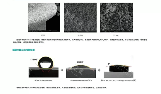 韩国inno伊诺种植牙好不好