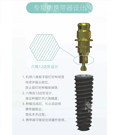 百康特种植牙六角设计优势图片