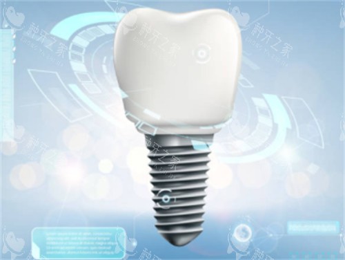 种植牙背景图 种植牙背景图