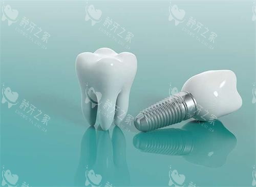 种植牙模具示意图 种植牙模具示意图