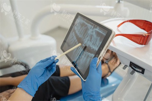 牙齿治疗沟通图 牙齿治疗沟通图