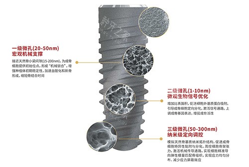 卡尔斯种植牙表面技术