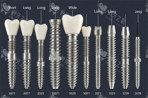 种植牙不同类型图 种植牙不同类型图