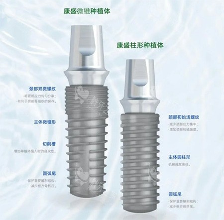 康盛微锥种植牙