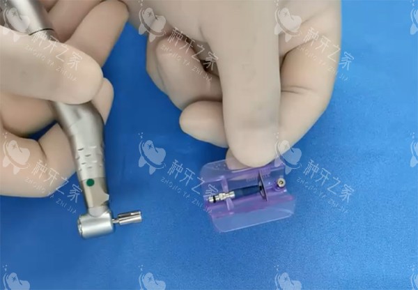 威高WEGO种植牙过程图