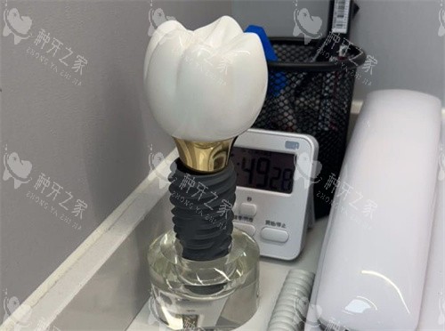 种植牙单颗模型 种植牙单颗模型