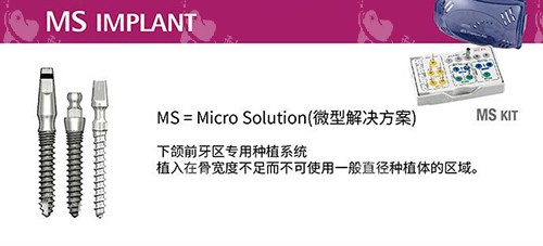奥齿泰种植牙MS系列