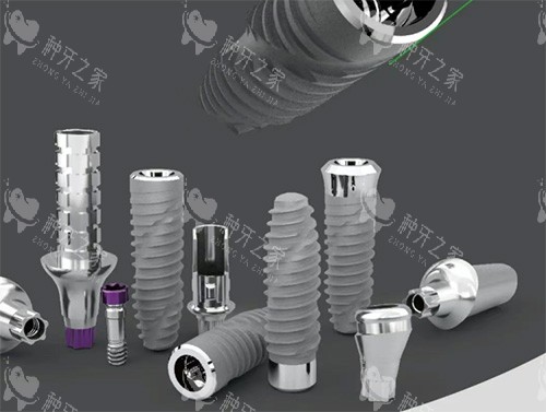 卡尔斯种植牙怎么样