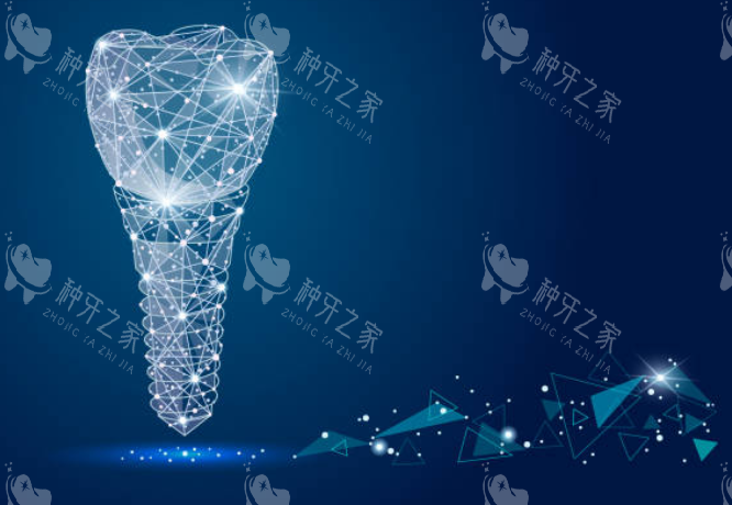 种植牙模拟图示意图