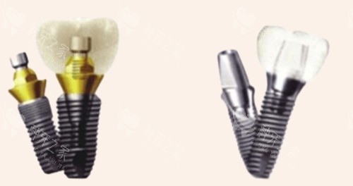 宁安牙博士口腔种植牙怎么样？小创口种牙不疼！