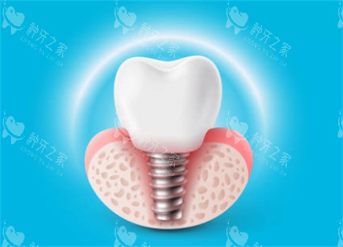 种植牙有光圈示意图