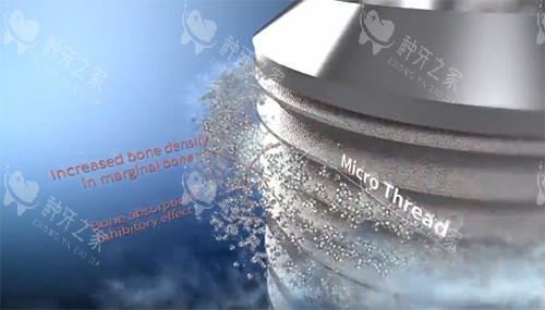 沃兰种植牙表面材料图 沃兰种植牙表面材料图