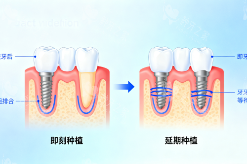 北京舒尔口腔种牙一颗多少钱？附各品牌价格明细！