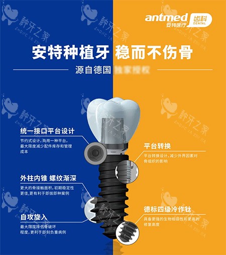 安特种植牙优点在哪里