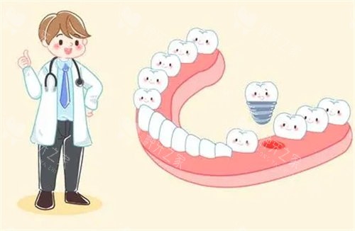 慈溪10家种牙口碑医院，性价比推荐！