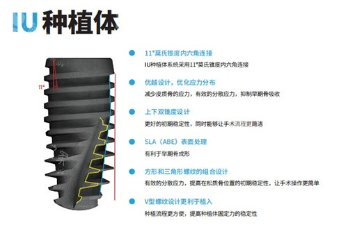 韩国沃兰种植牙怎么样