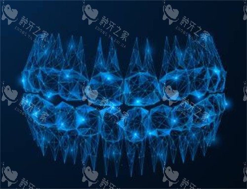 种植牙科幻示意图