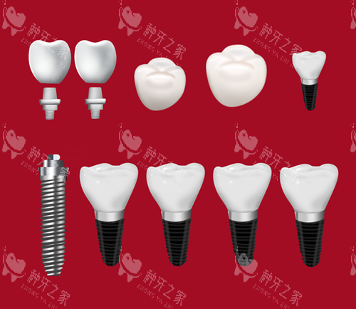 选择韩国奥齿泰种植牙:从流程到优势的完整指南!