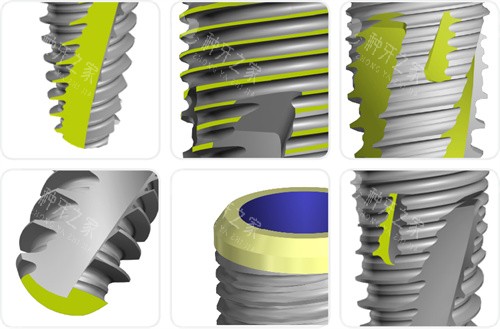 韩国奥齿泰和登腾哪个好?一张对比表帮你做抉择!