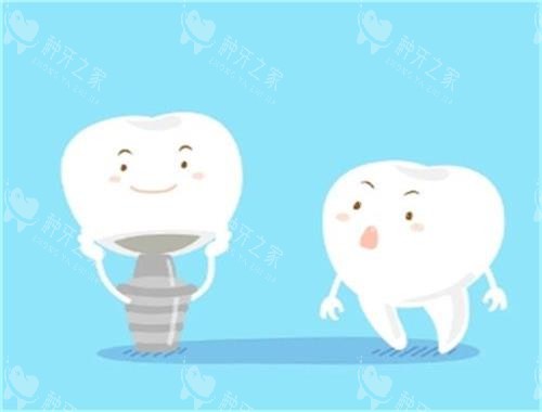 种植牙和健康牙对比图 种植牙和健康牙对比图