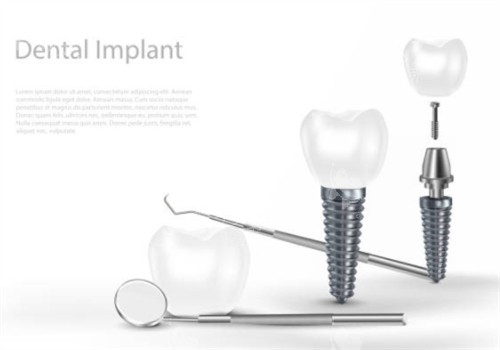 种植牙和器具示意图 种植牙和器具示意图