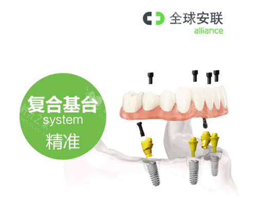 安联种植牙复合基台照片