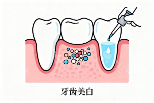 牙齿美白卡通展示图