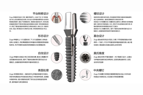 德国儒伽种植体优势特点图