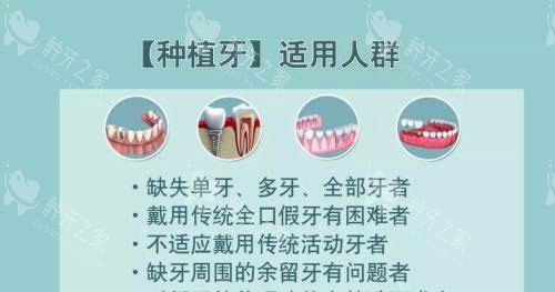 韩国登特4